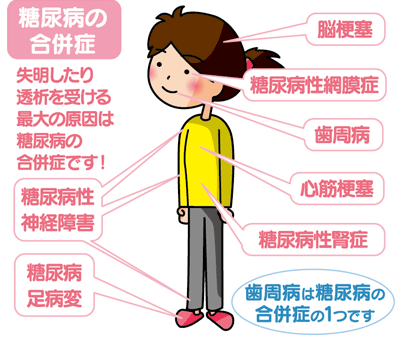 f:id:luismiquel:20200625183018p:plain