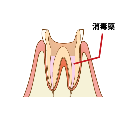 f:id:luismiquel:20200625220744p:plain